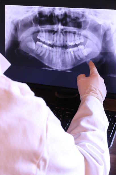 Best Broken or Chipped Tooth Repair in Katonah, NY