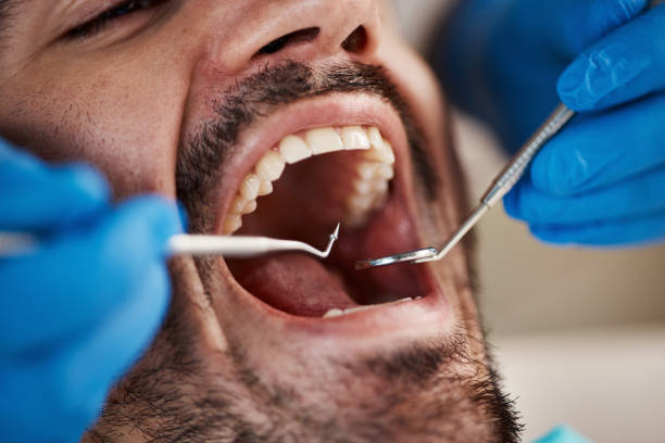 Best Emergency Dental Care for Sports Injuries in Katonah, NY
